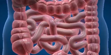 enfermidade, distúrbio, condição;