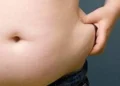 obesidade, excesso de peso, adiposidade;