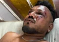 acidente, incidente, desastre';
